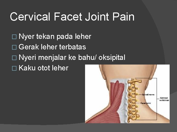 Cervical Facet Joint Pain � Nyer tekan pada leher � Gerak leher terbatas �