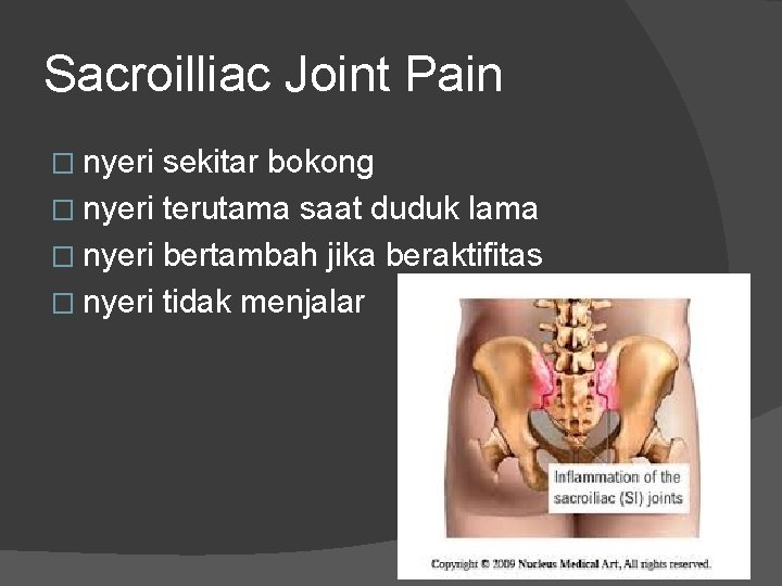 Sacroilliac Joint Pain � nyeri sekitar bokong � nyeri terutama saat duduk lama �