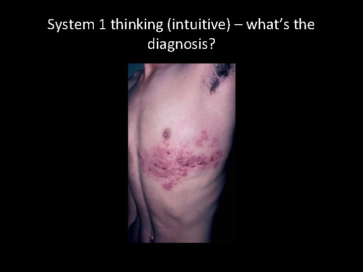 System 1 thinking (intuitive) – what’s the diagnosis? 