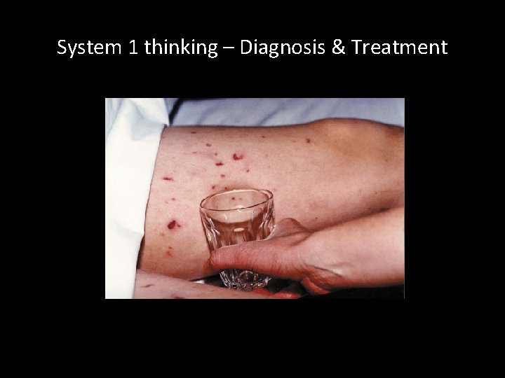 System 1 thinking – Diagnosis & Treatment 