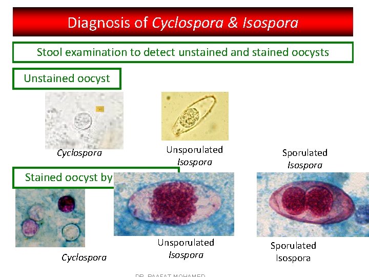 Diagnosis of Cyclospora & Isospora Stool examination to detect unstained and stained oocysts Unstained