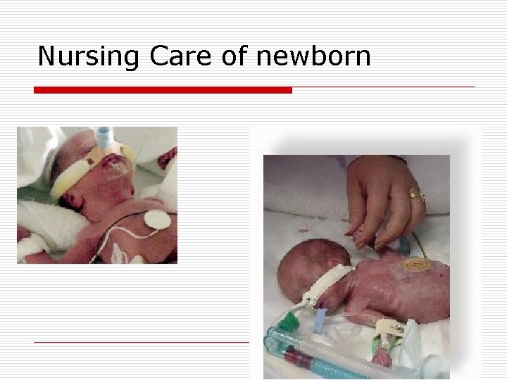 Nursing Care of newborn 