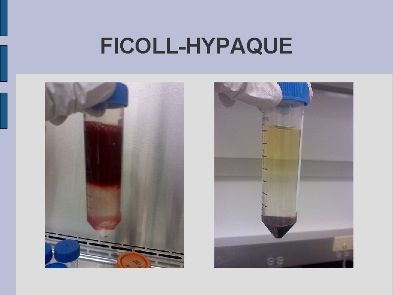 FICOLL-HYPAQUE 