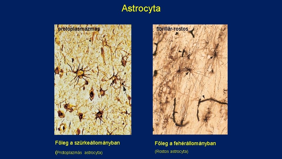 Astrocyta protoplasmazmás fibrillär-rostos Főleg a szürkeállományban Főleg a fehérállományban (Protoplazmás (Rostos astrocyta) 