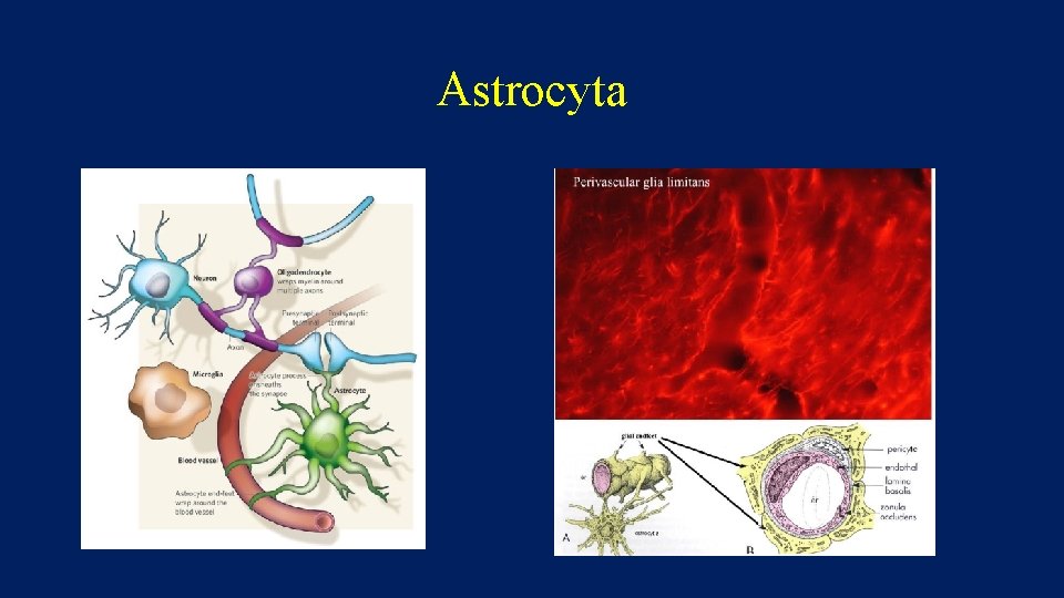 Astrocyta 