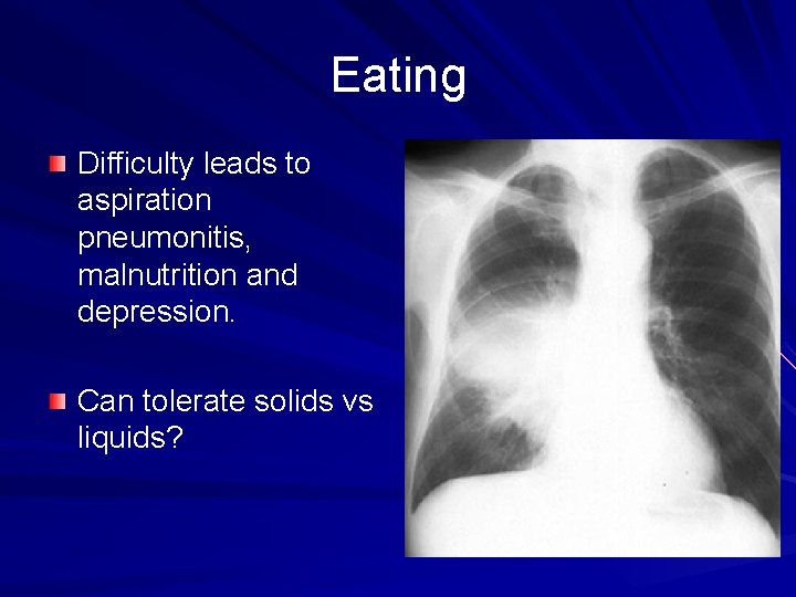 Eating Difficulty leads to aspiration pneumonitis, malnutrition and depression. Can tolerate solids vs liquids?