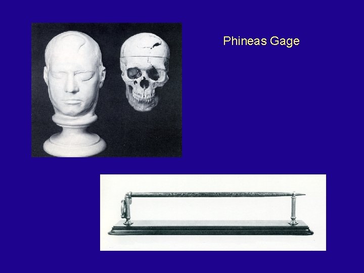 Phineas Gage 