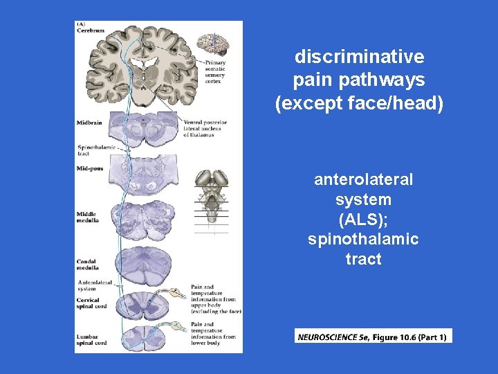 discriminative pain pathways (except face/head) anterolateral system (ALS); spinothalamic tract 