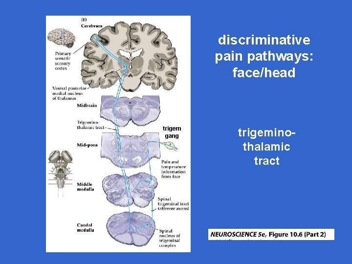 discriminative pain pathways: face/head trigem gang trigeminothalamic tract 