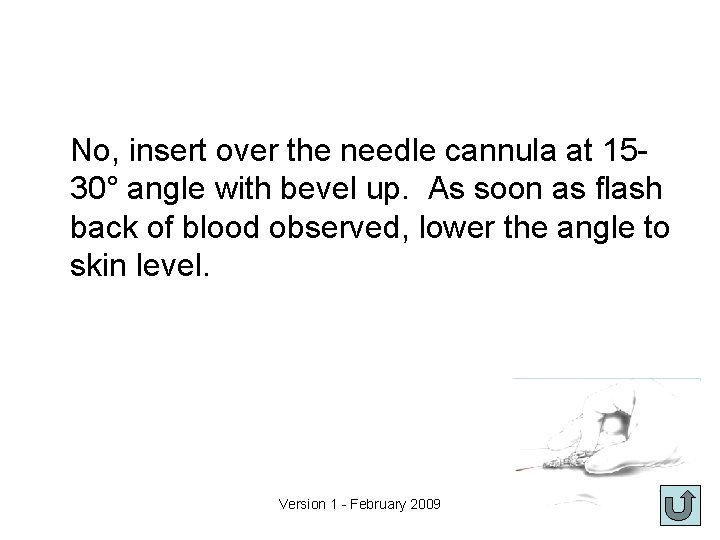 No, insert over the needle cannula at 1530° angle with bevel up. As soon