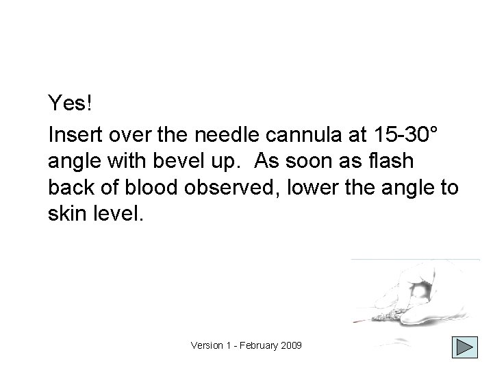 Yes! Insert over the needle cannula at 15 -30° angle with bevel up. As