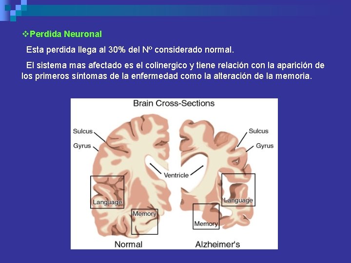 v. Perdida Neuronal Esta perdida llega al 30% del Nº considerado normal. El sistema