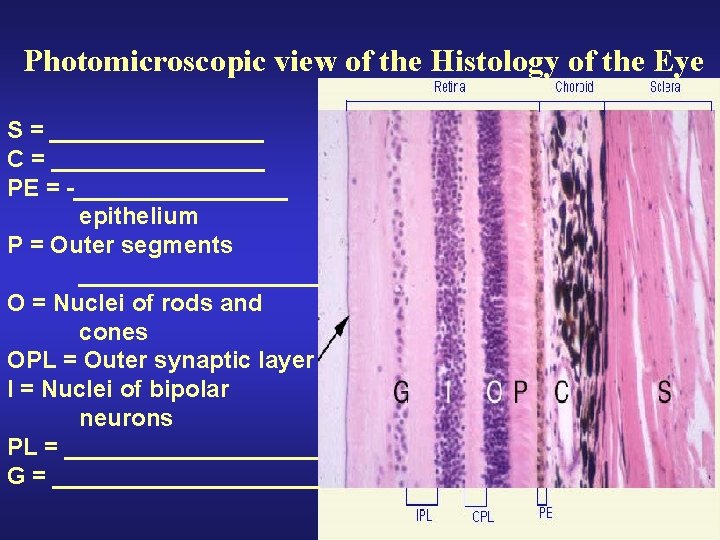 Photomicroscopic view of the Histology of the Eye S = ________ C = ________