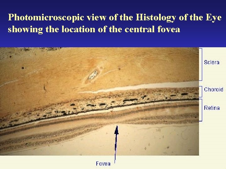 Photomicroscopic view of the Histology of the Eye showing the location of the central