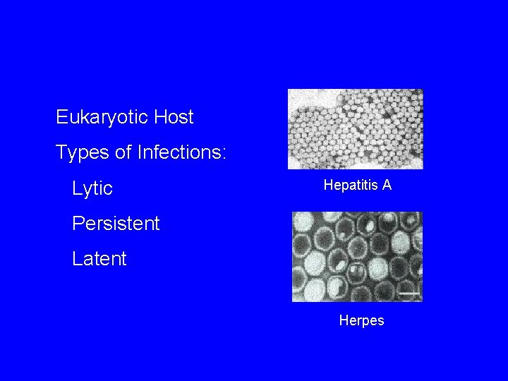 Eukaryotic Host Types of Infections: Lytic Hepatitis A Persistent Latent Herpes 
