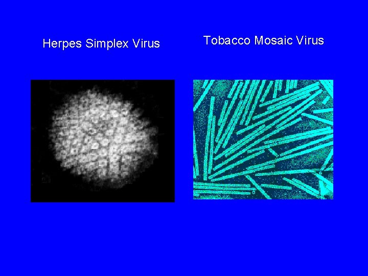 Herpes Simplex Virus Tobacco Mosaic Virus 