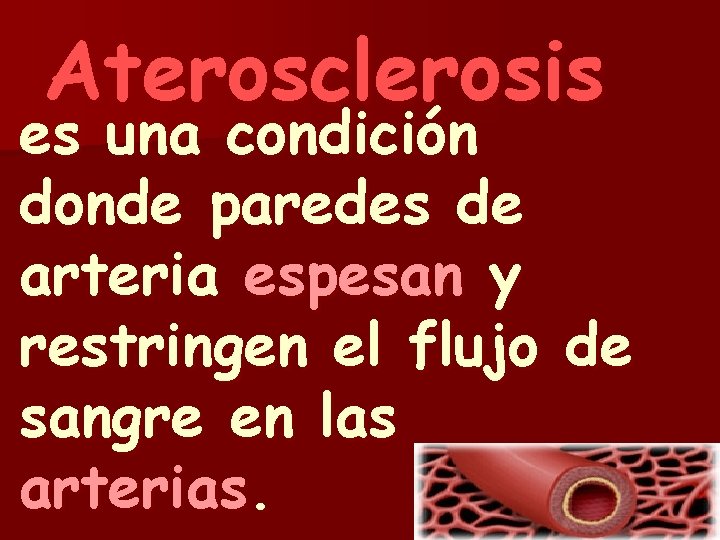 Aterosclerosis es una condición donde paredes de arteria espesan y restringen el flujo de