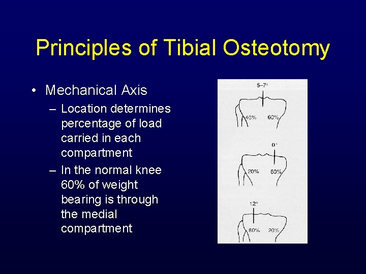 Principles of Tibial Osteotomy • Mechanical Axis – Location determines percentage of load carried