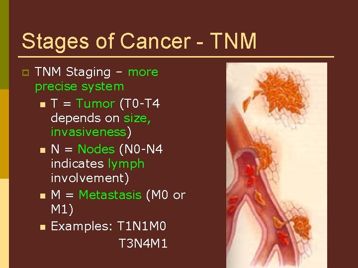 Stages of Cancer - TNM p TNM Staging – more precise system n T