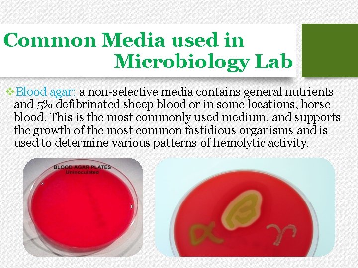 Common Media used in Microbiology Lab v. Blood agar: a non-selective media contains general