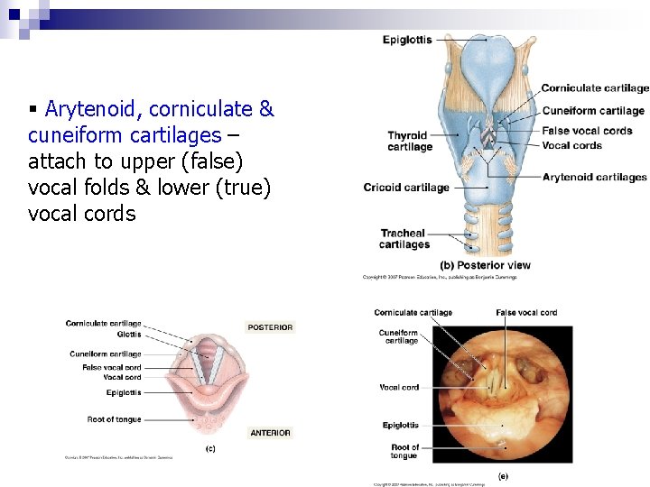 § Arytenoid, corniculate & cuneiform cartilages – attach to upper (false) vocal folds &