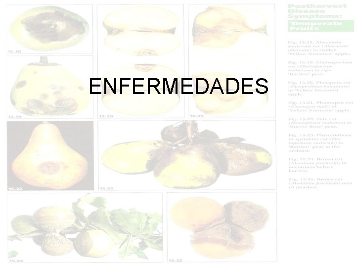 ENFERMEDADES 