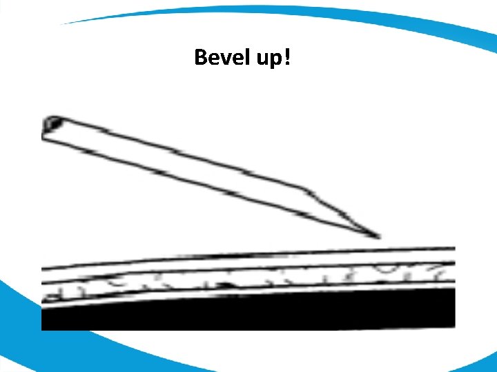 Bevel up! 