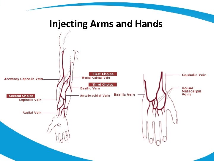 Injecting Arms and Hands 