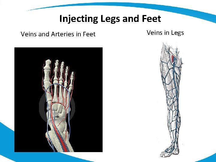 Injecting Legs and Feet Veins and Arteries in Feet Veins in Legs 