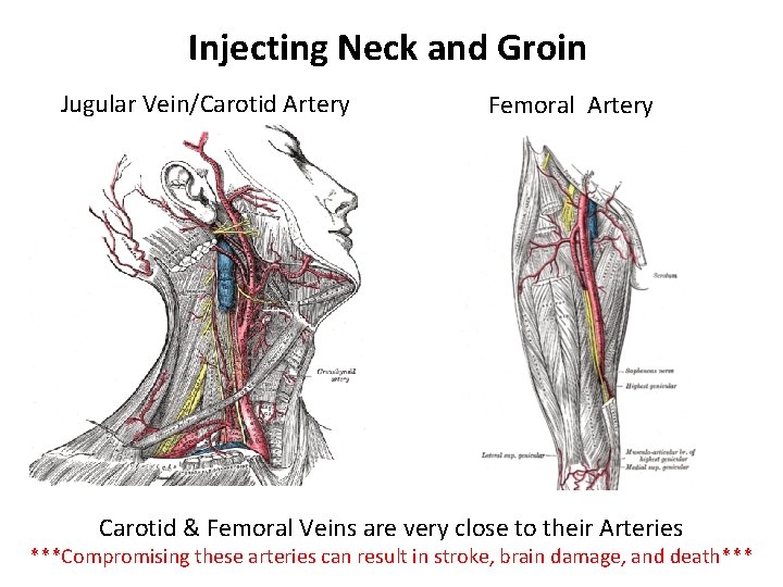 Injecting Neck and Groin Jugular Vein/Carotid Artery Femoral Artery Carotid & Femoral Veins are