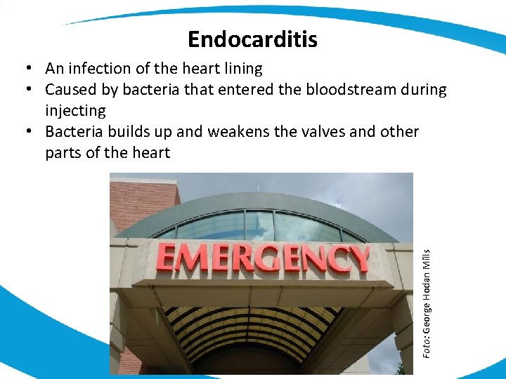 Endocarditis Foto: George Hodan Mills • An infection of the heart lining • Caused