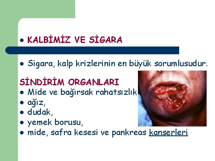 l KALBİMİZ VE SİGARA l Sigara, kalp krizlerinin en büyük sorumlusudur. SİNDİRİM ORGANLARI l