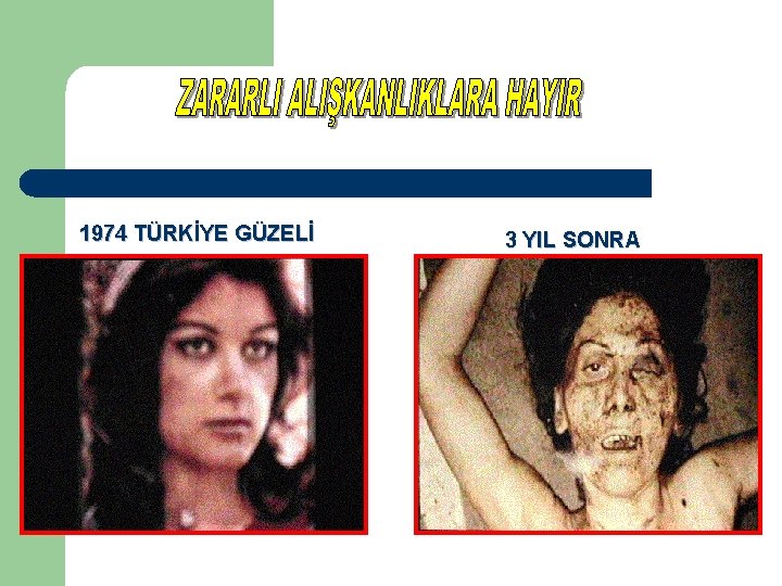 1974 TÜRKİYE GÜZELİ 3 YIL SONRA 