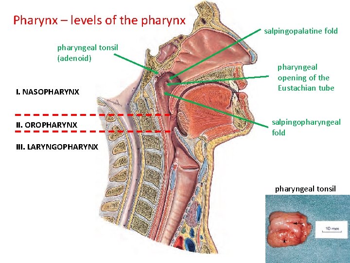 Pharynx – levels of the pharynx pharyngeal tonsil (adenoid) I. NASOPHARYNX II. OROPHARYNX salpingopalatine Pharynx – levels of the pharynx pharyngeal tonsil (adenoid) I. NASOPHARYNX II. OROPHARYNX salpingopalatine