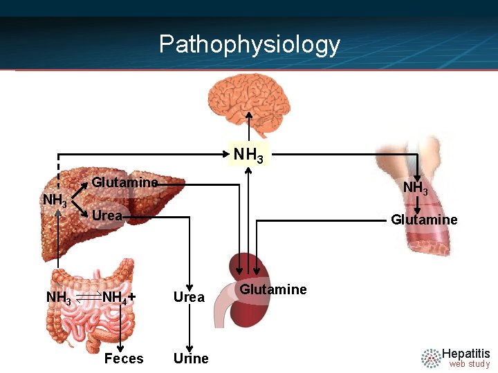 Pathophysiology NH 3 Glutamine NH 3 Urea Glutamine NH 4+ Urea Feces Urine Glutamine