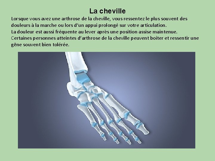 La cheville Lorsque vous avez une arthrose de la cheville, vous ressentez le plus