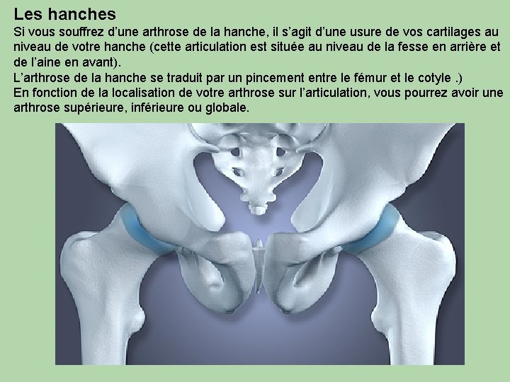 Les hanches Si vous souffrez d’une arthrose de la hanche, il s’agit d’une usure