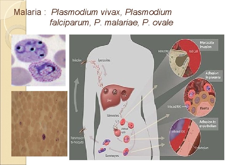Malaria : Plasmodium vivax, Plasmodium falciparum, P. malariae, P. ovale 