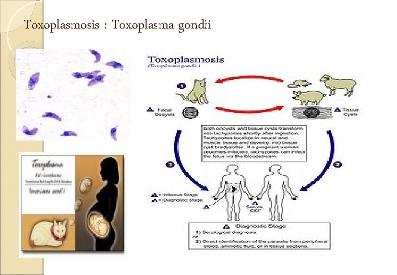 Toxoplasmosis : Toxoplasma gondii 