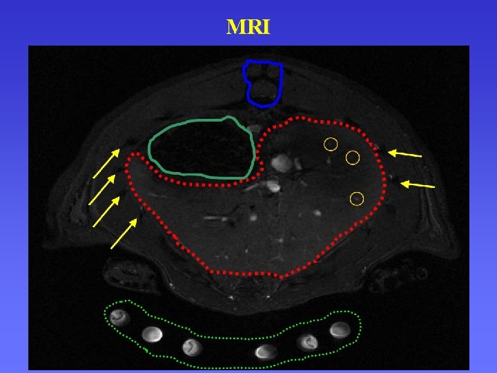 MRI 