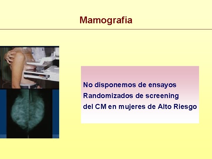 Mamografia No disponemos de ensayos Randomizados de screening del CM en mujeres de Alto