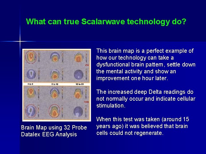 What can true Scalarwave technology do? This brain map is a perfect example of What can true Scalarwave technology do? This brain map is a perfect example of