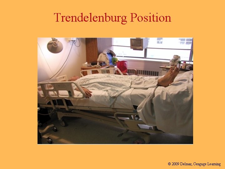 Trendelenburg Position © 2009 Delmar, Cengage Learning 