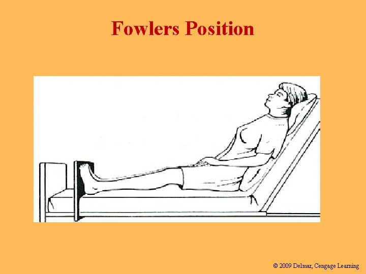 Fowlers Position © 2009 Delmar, Cengage Learning 