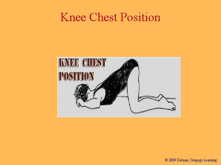 Knee Chest Position © 2009 Delmar, Cengage Learning 