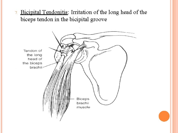 7. Bicipital Tendonitis: Irritation of the long head of the biceps tendon in the