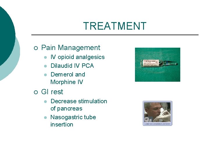 TREATMENT ¡ Pain Management l l l ¡ IV opioid analgesics Dilaudid IV PCA