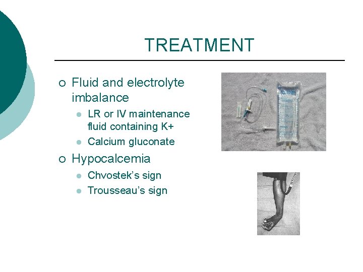 TREATMENT ¡ Fluid and electrolyte imbalance l l ¡ LR or IV maintenance fluid