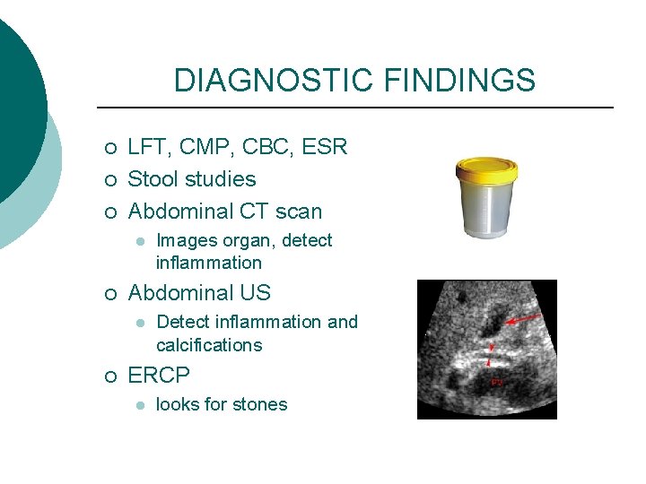 DIAGNOSTIC FINDINGS ¡ ¡ ¡ LFT, CMP, CBC, ESR Stool studies Abdominal CT scan