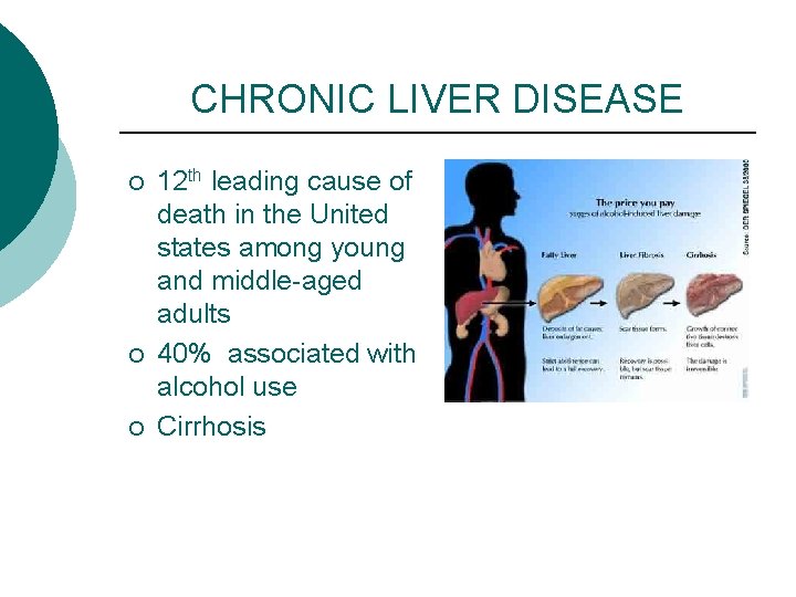 CHRONIC LIVER DISEASE ¡ ¡ ¡ 12 th leading cause of death in the